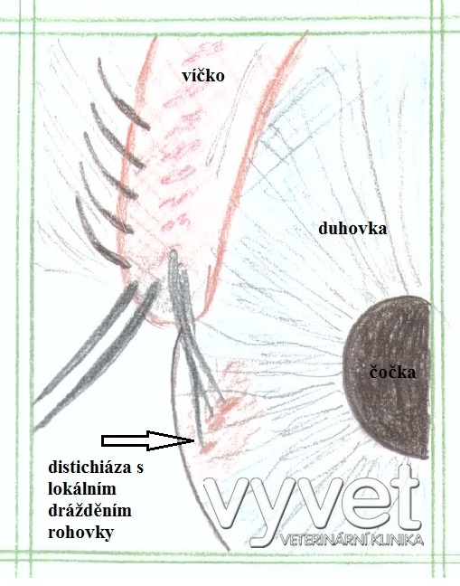 distichiáza-kresba-vyvet 